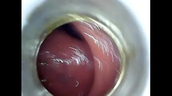 Gorące Homemade anal insertion endoscopenowe klipy